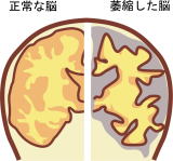 �N���j�b�N�O��